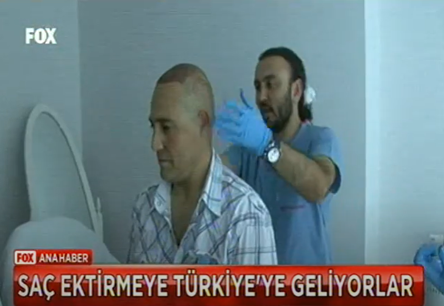 Op. Dr. Deniz KÜÇÜKKAYA – Türkiye’de Saç Ekimi (Ana Haber – Fox TV)