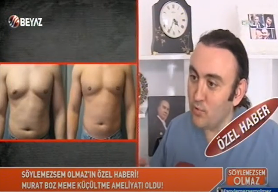 Op. Dr. Deniz Küçükkaya – Meme Küçültme (Beyaz TV)