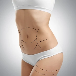 kobine-operasyon copy